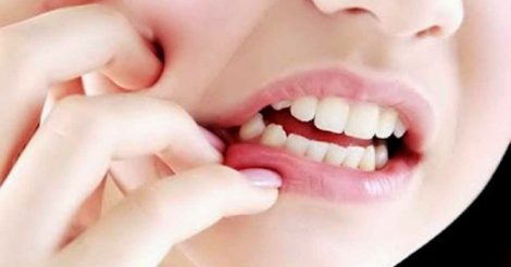 7 Penyebab Gigi Ngilu yang Wajib Anda Ketahui